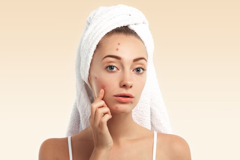 10-Skincare-Mistakes-PoppingPimples